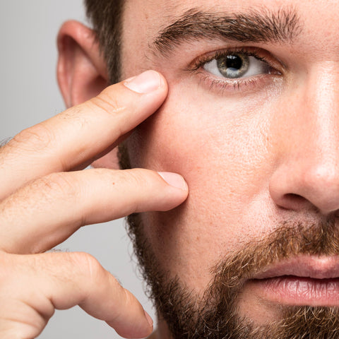 How to remove dark circles and bags under your eyes for good