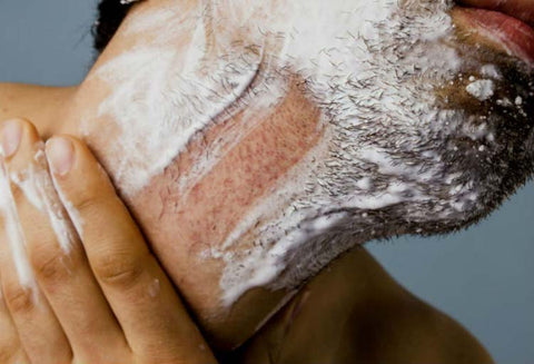 Men’s Skincare Tips: How to Reduce Redness and Irritation